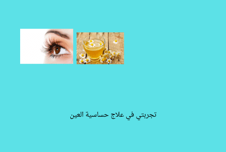 علاج حساسية العين في أسبوع
